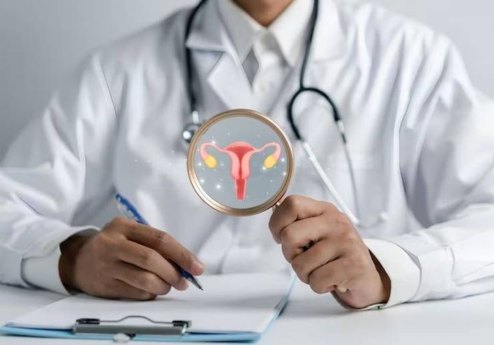 PCOS Explained: Symptoms, Causes, Diagnosis and Management